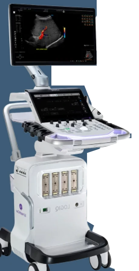 GE HealthCare LOGIQ Totus 초음파 시스템
